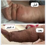 IMG 20240319 WA00071