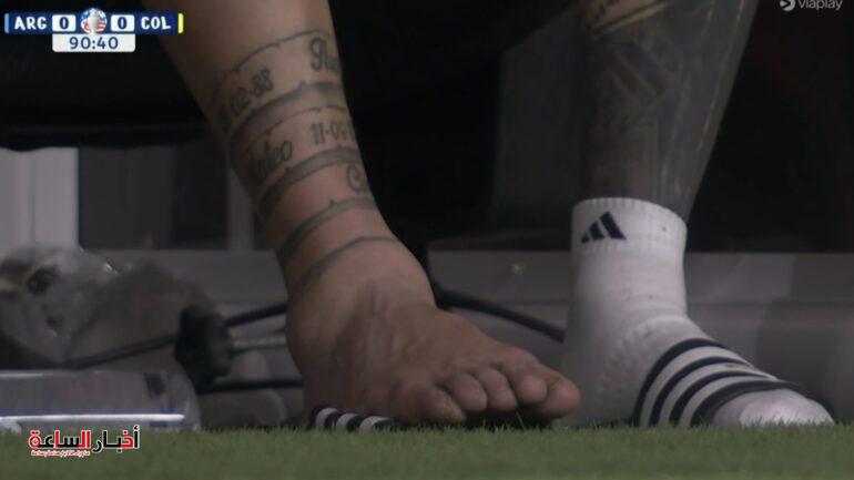 صور مرعبة لإصابة ميسي في نهائي كوبا أمريكا