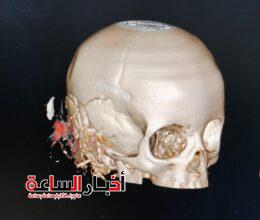 akhbarelsaa.com 53PRbRPi