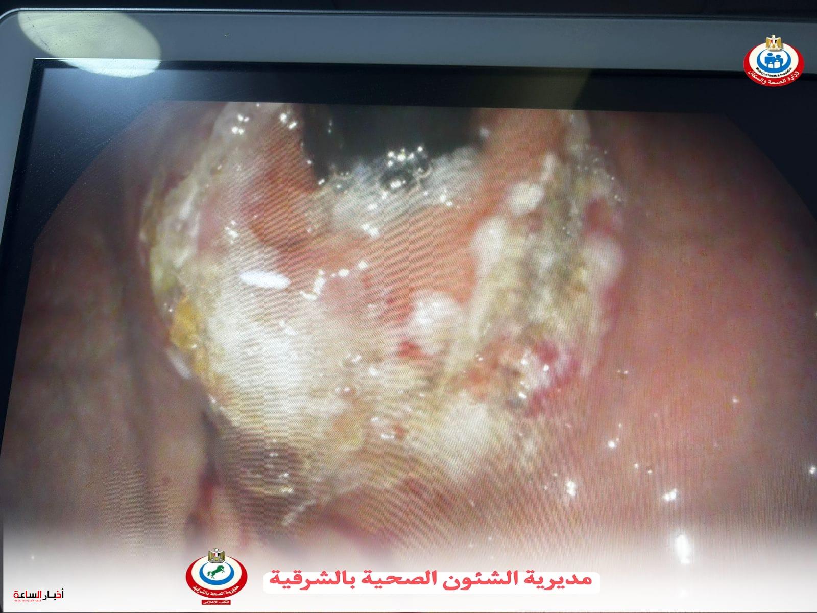 akhbarelsaa.com t5TNEfbb